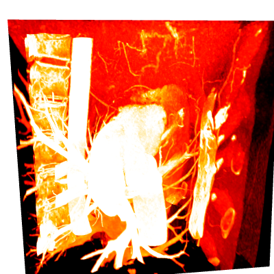 Maximum intensity maximum_intensity
