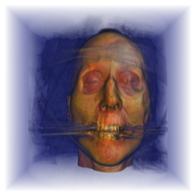 RayCasting with shading example 1 raycasting_shading_example_1